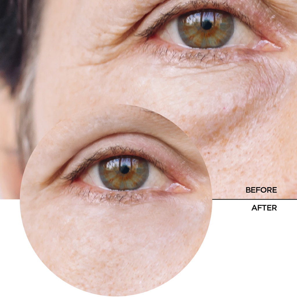 Revox Caffeine 5% Serum 30ml