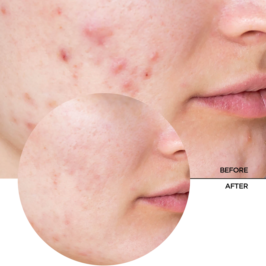 Revox Niacinamide 10% 30ml