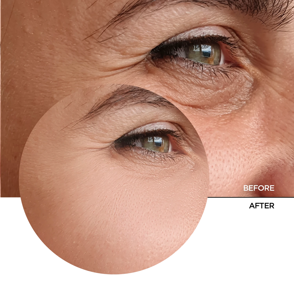 Revox Retinal 0.2% Fluid 30ml
